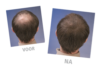 voller-haar-mannen-42_2 Voller haar mannen